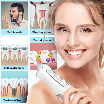 Portable Water Flosser – IPX7 Waterproof Dental Cleaner & Oral Irrigator